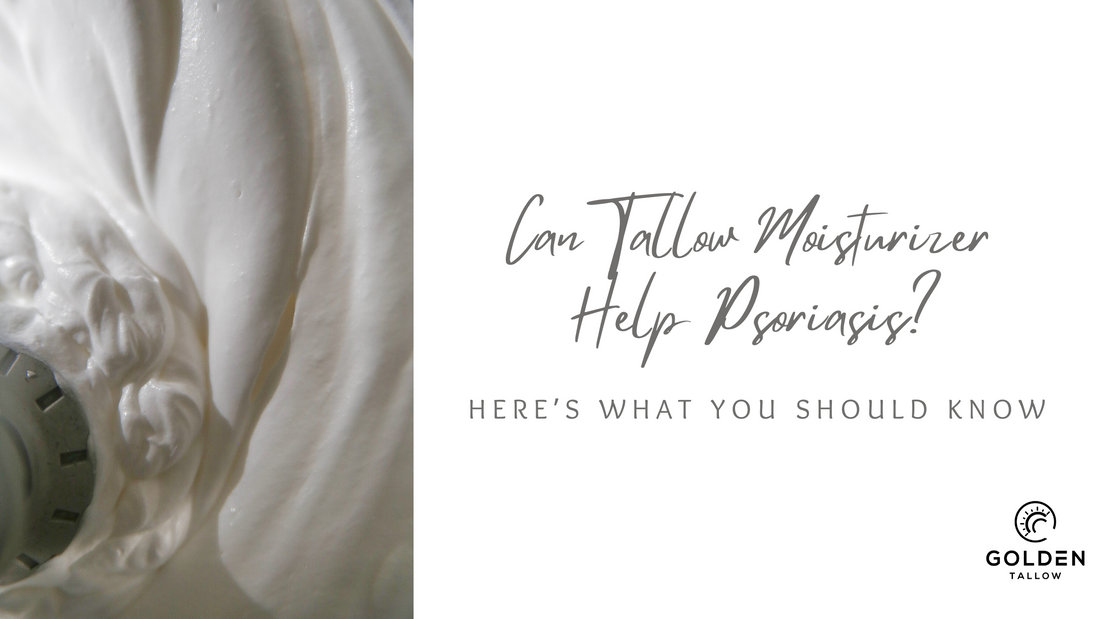 Can Tallow Moisturizer Help Psoriasis? Here’s What You Should Know