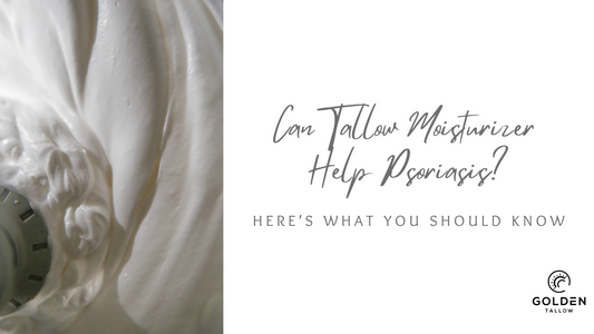 Can Tallow Moisturizer Help Psoriasis? Here’s What You Should Know