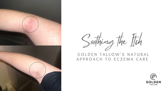 Soothing the Itch: Golden Tallow's Natural Approach to Eczema Care