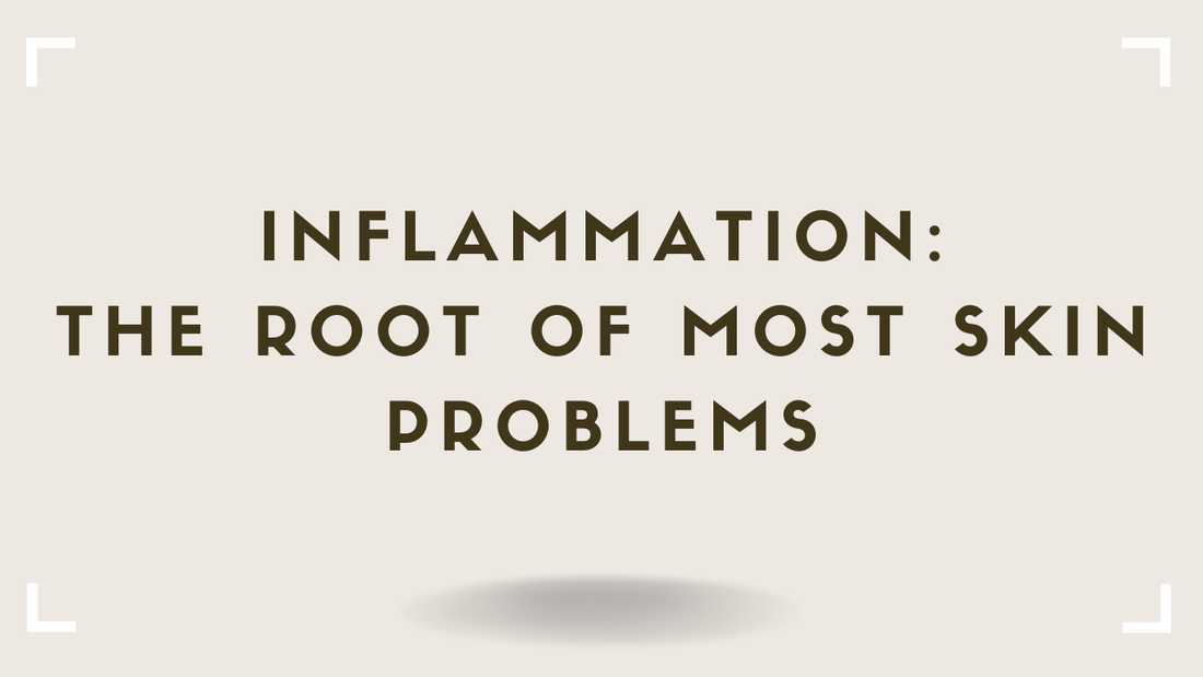 Inflammation The Root of Most Skin Problems