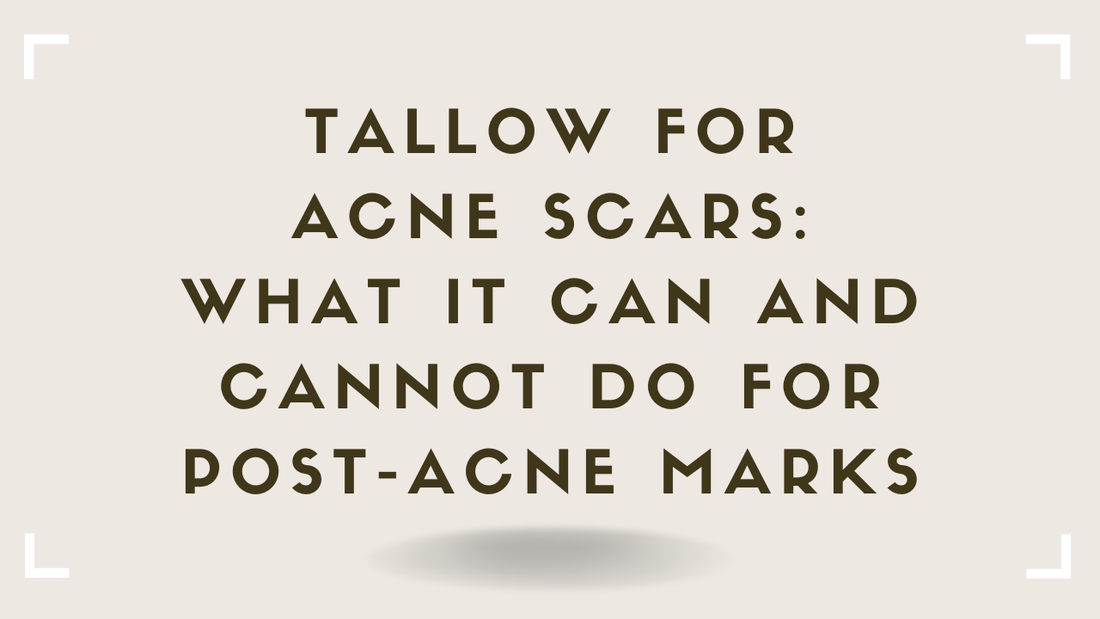 Tallow for Acne Scars What It Can and Cannot Do for Post-Acne Marks