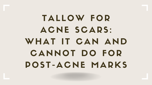 Tallow for Acne Scars What It Can and Cannot Do for Post-Acne Marks